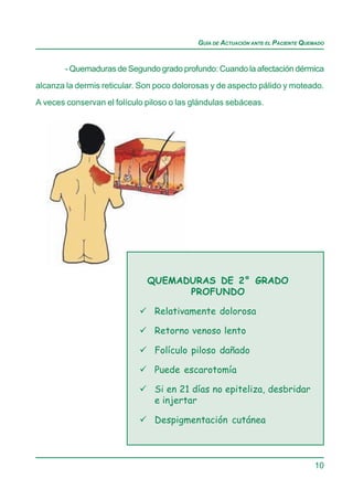 GUÍA DE ACTUACIÓN ANTE EL PACIENTE QUEMADO


        - Quemaduras de Segundo grado profundo: Cuando la afectación dérmica

alcanza la dermis reticular. Son poco dolorosas y de aspecto pálido y moteado.
A veces conservan el folículo piloso o las glándulas sebáceas.




                              QUEMADURAS DE 2° GRADO
                                    PROFUNDO

                                Relativamente dolorosa

                                Retorno venoso lento

                                Folículo piloso dañado

                                Puede escarotomía

                                Si en 21 días no epiteliza, desbridar
                                e injertar

                                Despigmentación cutánea



                                                                                  10
 