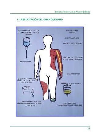 GUÍA DE ACTUACIÓN ANTE EL PACIENTE QUEMADO



3.1. RESUCITACIÓN DEL GRAN QUEMADO




                                                                  23
 