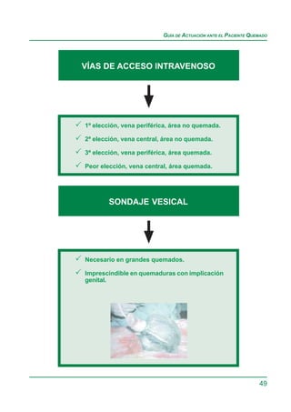 GUÍA DE ACTUACIÓN ANTE EL PACIENTE QUEMADO




VÍAS DE ACCESO INTRAVENOSO




1ª elección, vena periférica, área no quemada.

2ª elección, vena central, área no quemada.

3ª elección, vena periférica, área quemada.

Peor elección, vena central, área quemada.




        SONDAJE VESICAL




Necesario en grandes quemados.

Imprescindible en quemaduras con implicación
genital.




                                                                49
 