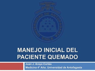 MANEJO INICIAL DEL
PACIENTE QUEMADO
Juan J. Araya Cortés
Medicina 4° Año. Universidad de Antofagasta
 