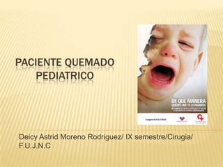 PACIENTE QUEMADO
   PEDIATRICO




Deicy Astrid Moreno Rodriguez/ IX semestre/Cirugia/
F.U.J.N.C
 