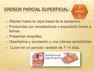 GROSOR PARCIAL SUPERFICIAL:                 2º
                                           GRAD
                                            O
   Afectan hasta la capa basal de la epidermis.
   Producidas por escaldaduras o exposición breve a
    llamas.
   Presentan ampollas,
   Hiperhemia y exudación y una intensa sensibilidad.
   Curan en un periodo variable de 7-14 días.
 