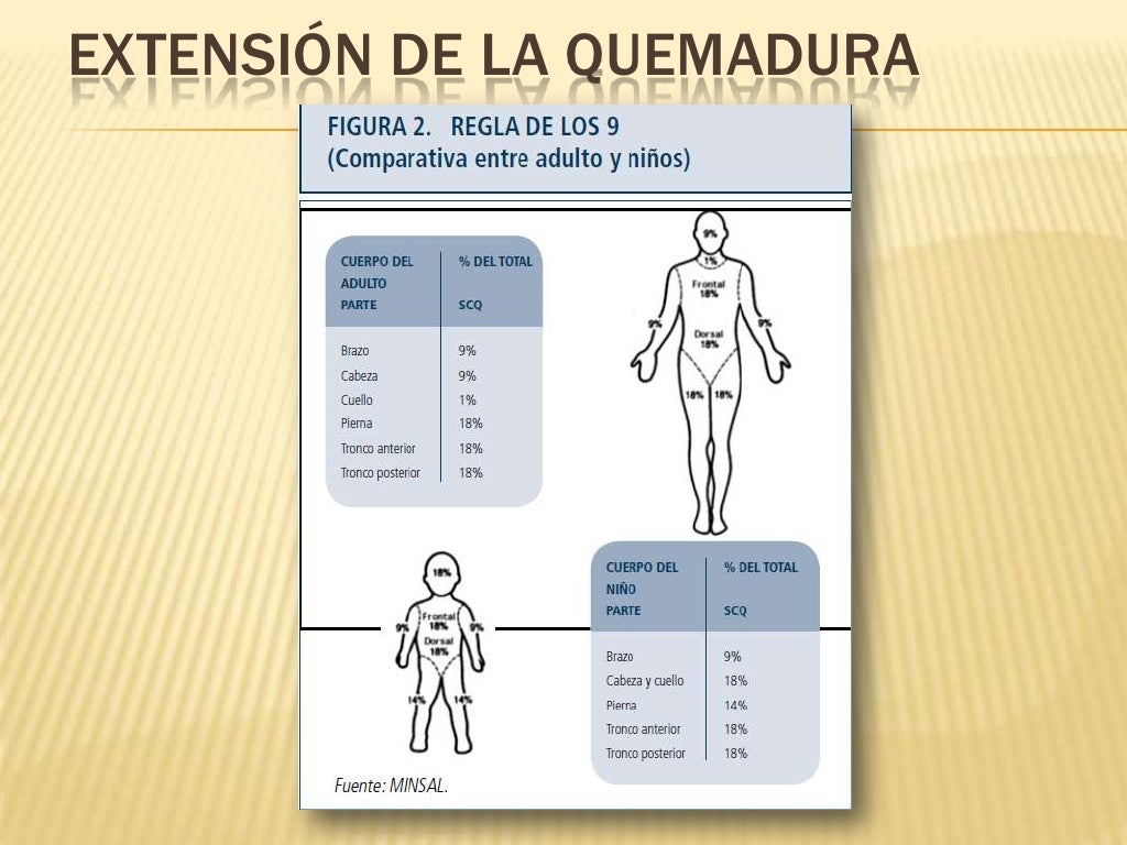 Paciente quemado pediatrico