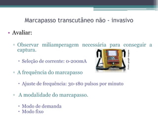 Marcapasso transcutâneo não - invasivo
• Avaliar:
▫ Observar miliamperagem necessária para conseguir a
captura.
 Seleção de corrente: 0-200mA
▫ A frequência do marcapasso
 Ajuste de frequência: 30-180 pulsos por minuto
▫ A modalidade do marcapasso.
 Modo de demanda
 Modo fixo
Fonte:googleimagens
 