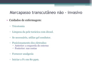 Marcapasso transcutâneo não - invasivo
• Cuidados de enfermagem:
▫ Tricotomia
▫ Limpeza da pele torácica com álcool.
▫ Se necessário, utilize gel condutor.
▫ Posicionamento dos eletrodos:
 Anterior: a esquerda do esterno
 Posterior: nas costas
▫ Fornecer analgesia
▫ Iniciar a Fc em 80 ppm.
 