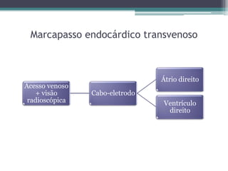 Marcapasso endocárdico transvenoso
Acesso venoso
+ visão
radioscópica
Cabo-eletrodo
Átrio direito
Ventrículo
direito
 