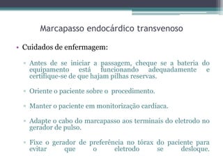 Marcapasso endocárdico transvenoso
• Cuidados de enfermagem:
▫ Antes de se iniciar a passagem, cheque se a bateria do
equipamento está funcionando adequadamente e
certifique-se de que hajam pilhas reservas.
▫ Oriente o paciente sobre o procedimento.
▫ Manter o paciente em monitorização cardíaca.
▫ Adapte o cabo do marcapasso aos terminais do eletrodo no
gerador de pulso.
▫ Fixe o gerador de preferência no tórax do paciente para
evitar que o eletrodo se desloque.
 