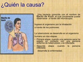 ¿Quién la causa?
Una bacteria conocida con el nombre de
Bacilo de Koch, el cual únicamente puede
observarse a través del microscopio.
Ingresa al organismo por la inhalación
a través de los pulmones.
La tuberculosis se desarrolla en el organismo
humano en dos etapas:
• Primera etapa: cuando una persona sana ha
estado en contacto con una persona
enferma de tuberculosis y es infectada;
• Segunda etapa: cuando la persona
infectada
desarrolla la enfermedad.
 