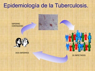 Epidemiología de la Tuberculosis.
DOS ENFERMOS
ENFERMO
CONTAGIOSO
20 INFECTADOS
 