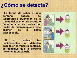 ¿Cómo se detecta?
La forma de saber si una
persona padece de
tuberculosis pulmonar es a
través del examen de esputo o
flema el cual se realiza por
medio de microscopio; a este
examen se le llama
baciloscopía.
Si al realizar las
baciloscopias se detectan
bacilos en la muestra de flema,
se concluye que la persona
presenta tuberculosis.
 