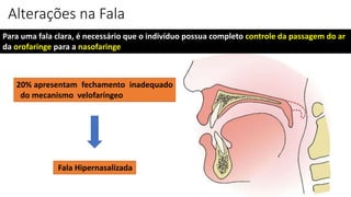 Alterações na Fala
Para uma fala clara, é necessário que o indivíduo possua completo controle da passagem do ar
da orofaringe para a nasofaringe
20% apresentam fechamento inadequado
do mecanismo velofaríngeo
Fala Hipernasalizada
 
