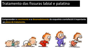 Compreender o crescimento e o desenvolvimento do esqueleto craniofacial é importante
ao plano de tratamento.
Tratamento das fissuras labial e palatina
 
