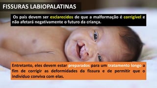 Os pais devem ser esclarecidos de que a malformação é corrigível e
não afetará negativamente o futuro da criança.
Entretanto, eles devem estar preparados para um tratamento longo a
fim de corrigir as deformidades da fissura e de permitir que o
indivíduo conviva com elas.
FISSURAS LABIOPALATINAS
 