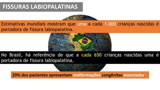 No Brasil, há referência de que a cada 650 crianças nascidas uma é
portadora de fissura labiopalatina.
Estimativas mundiais mostram que uma a cada 1.000 crianças nascidas é
portadora de fissura labiopalatina.
29% dos pacientes apresentam malformações congênitas associadas.
FISSURAS LABIOPALATINAS
 