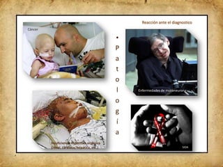 Reacción ante el diagnostico
Cáncer

                                             •
                                             P
                                             a
                                             t
                                             o
                                             l   Enfermedades de motoneurona

                                             o
                                             g
                                             í
                                             a
         Insuficiencia específica orgánica
         (renal, cardiaca, hepática, etc.)                               SIDA
 