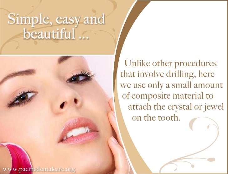 Pacific Dental Care Denstist in Burbank Tooth Jewelry