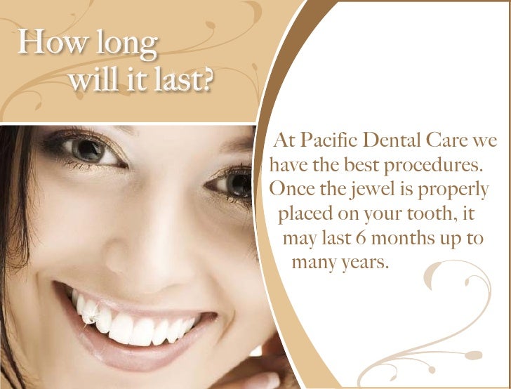 Pacific Dental Care Denstist in Burbank Tooth Jewelry