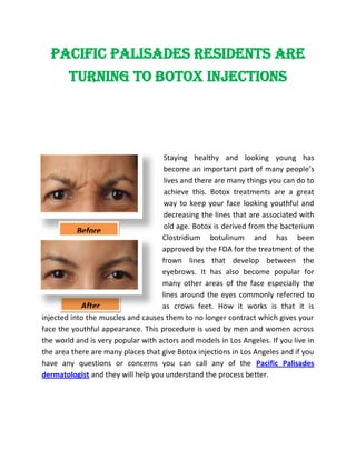 Pacific Palisades Residents Are
        Turning to Botox Injections




                                     Staying healthy and looking young has
                                     become an important part of many people’s
                                     lives and there are many things you can do to
                                     achieve this. Botox treatments are a great
                                     way to keep your face looking youthful and
                                     decreasing the lines that are associated with
                                     old age. Botox is derived from the bacterium
           Before
                                    Clostridium botulinum and has been
                                    approved by the FDA for the treatment of the
                                    frown lines that develop between the
                                    eyebrows. It has also become popular for
                                    many other areas of the face especially the
                                    lines around the eyes commonly referred to
            After                   as crows feet. How it works is that it is
injected into the muscles and causes them to no longer contract which gives your
face the youthful appearance. This procedure is used by men and women across
the world and is very popular with actors and models in Los Angeles. If you live in
the area there are many places that give Botox injections in Los Angeles and if you
have any questions or concerns you can call any of the Pacific Palisades
dermatologist and they will help you understand the process better.
 