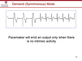 12
Demand (Synchronous) Mode
Pacemaker will emit an output only when there
is no intrinsic activity
 