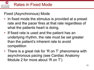13
Rates in Fixed Mode
Fixed (Asynchronous) Mode
• In fixed mode the stimulus is provided at a preset
rate and the pacer fires at that rate regardless of
what the patients heart is doing.
• If fixed rate is used and the patient has an
underlying rhythm, the rate must be set greater
than the patient‟s inherent rate to avoid
competition
• There is a great risk for „R on T‟ phenomena with
asynchronous pacing (see Cardiac Anatomy
Module 2 for more about „R on T‟)
 