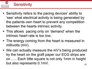 20
 Sensitivity refers to the pacing devices‟ ability to
„see‟ what electrical activity is being generated by
the patients own heart to prevent any competition
between the hearts intrinsic activity.
 This allows pacing only on „demand‟ when the
intrinsic heart rate is too low,
 The energy coming from the heart is measured in
millivolts (mV).
 We can actually measure the mV‟s being produced
by the heart on the graft paper our ECG strips are
on ….. Each little square is not only 1mm in height
but also represents 0.1mV.
Sensitivity
 
