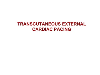 TRANSCUTANEOUS EXTERNAL
CARDIAC PACING
 
