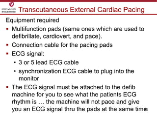 30
Equipment required
 Multifunction pads (same ones which are used to
defibrillate, cardiovert, and pace).
 Connection cable for the pacing pads
 ECG signal:
• 3 or 5 lead ECG cable
• synchronization ECG cable to plug into the
monitor
 The ECG signal must be attached to the defib
machine for you to see what the patients ECG
rhythm is … the machine will not pace and give
you an ECG signal thru the pads at the same time.
Transcutaneous External Cardiac Pacing
 