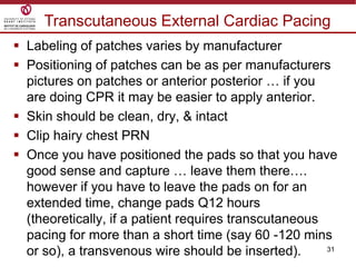 31
 Labeling of patches varies by manufacturer
 Positioning of patches can be as per manufacturers
pictures on patches or anterior posterior … if you
are doing CPR it may be easier to apply anterior.
 Skin should be clean, dry, & intact
 Clip hairy chest PRN
 Once you have positioned the pads so that you have
good sense and capture … leave them there….
however if you have to leave the pads on for an
extended time, change pads Q12 hours
(theoretically, if a patient requires transcutaneous
pacing for more than a short time (say 60 -120 mins
or so), a transvenous wire should be inserted).
Transcutaneous External Cardiac Pacing
 