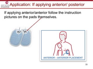 33
Application: If applying anterior/ posterior
If applying anterior/anterior follow the instruction
pictures on the pads themselves.
 