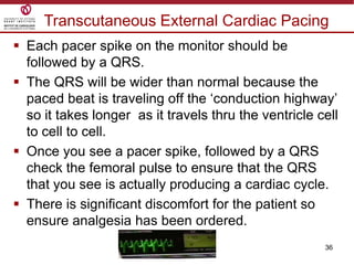 36
 Each pacer spike on the monitor should be
followed by a QRS.
 The QRS will be wider than normal because the
paced beat is traveling off the „conduction highway‟
so it takes longer as it travels thru the ventricle cell
to cell to cell.
 Once you see a pacer spike, followed by a QRS
check the femoral pulse to ensure that the QRS
that you see is actually producing a cardiac cycle.
 There is significant discomfort for the patient so
ensure analgesia has been ordered.
Transcutaneous External Cardiac Pacing
 