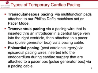 4
Types of Temporary Cardiac Pacing
 Transcutaneaous pacing via multifunction pads
attached to our Philips Defib machines set on
Pacer Mode.
 Transvenous pacing via a pacing wire that is
inserted thru an introducer in a central large vein
into the right ventricle, then attached to a pacer
box (pulse generator box) via a pacing cable.
 Epicardial pacing (post cardiac surgery) via
epicardial pacing wires inserted into the
endocardium during cardiac surgery that are
attached to a pacer box (pulse generator box) via
a pacing cable.
 