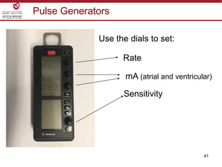 41
Pulse Generators
Use the dials to set:
Rate
mA (atrial and ventricular)
Sensitivity
 