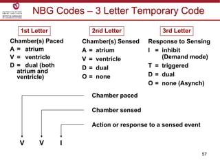 57
NBG Codes – 3 Letter Temporary Code
Chamber(s) Paced
A = atrium
V = ventricle
D = dual (both
atrium and
ventricle)
1st Letter
Chamber(s) Sensed
A = atrium
V = ventricle
D = dual
O = none
2nd Letter
Response to Sensing
I = inhibit
(Demand mode)
T = triggered
D = dual
O = none (Asynch)
3rd Letter
V V I
Chamber paced
Chamber sensed
Action or response to a sensed event
 