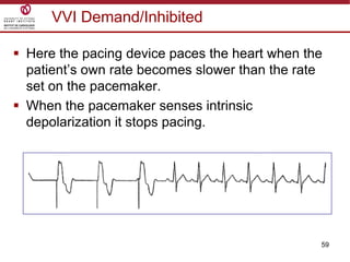 59
VVI Demand/Inhibited
 Here the pacing device paces the heart when the
patient‟s own rate becomes slower than the rate
set on the pacemaker.
 When the pacemaker senses intrinsic
depolarization it stops pacing.
 