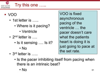 61
Try this one …..
 VOO
• 1st letter is …..
• Where is it pacing?
• Ventricle
• 2nd letter is ….
• Is it sensing …. Is it?
• No
• 3rd letter is …..
• Is the pacer inhibiting itself from pacing when
there is an intrinsic beat?
• No
VOO is fixed
asynchronous
pacing of the
ventricle … the
pacer doesn‟t care
what the patients
heart is doing it is
just going to pace at
the set rate.
 