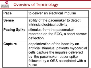7
Overview of Terminology
Pace to deliver an electrical impulse
Sense ability of the pacemaker to detect
intrinsic electrical activity
Pacing Spike stimulus from the pacemaker
recorded on the ECG, a short narrow
deflection
Capture depolarization of the heart by an
artificial stimulus; patients myocardial
cells capture the impulse delivered
by the pacemaker; pacer spike
followed by a QRS associated with a
pulse
 