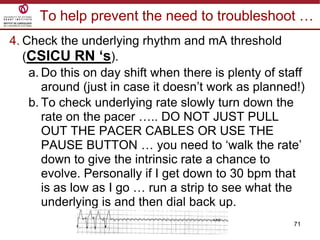 71
To help prevent the need to troubleshoot …
4. Check the underlying rhythm and mA threshold
(CSICU RN ‘s).
a. Do this on day shift when there is plenty of staff
around (just in case it doesn‟t work as planned!)
b. To check underlying rate slowly turn down the
rate on the pacer ….. DO NOT JUST PULL
OUT THE PACER CABLES OR USE THE
PAUSE BUTTON … you need to „walk the rate‟
down to give the intrinsic rate a chance to
evolve. Personally if I get down to 30 bpm that
is as low as I go … run a strip to see what the
underlying is and then dial back up.
 