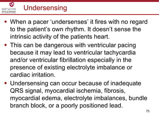 75
Undersensing
 When a pacer „undersenses‟ it fires with no regard
to the patient‟s own rhythm. It doesn‟t sense the
intrinsic activity of the patients heart.
 This can be dangerous with ventricular pacing
because it may lead to ventricular tachycardia
and/or ventricular fibrillation especially in the
presence of existing electrolyte imbalance or
cardiac irritation.
 Undersensing can occur because of inadequate
QRS signal, myocardial ischemia, fibrosis,
myocardial edema, electrolyte imbalances, bundle
branch block, or a poorly positioned lead.
 