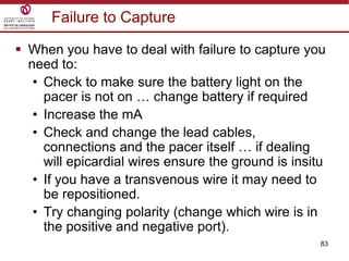 83
Failure to Capture
 When you have to deal with failure to capture you
need to:
• Check to make sure the battery light on the
pacer is not on … change battery if required
• Increase the mA
• Check and change the lead cables,
connections and the pacer itself … if dealing
will epicardial wires ensure the ground is insitu
• If you have a transvenous wire it may need to
be repositioned.
• Try changing polarity (change which wire is in
the positive and negative port).
 