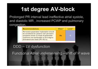 1st degree AV-block
Prolonged PR interval lead ineffective atrial systole,
and diastolic MR , increased PCWP and pulmonary
congestion.
DDD -- LV dysfunction
Functional Atrial undersensing --shift of P wave
 
