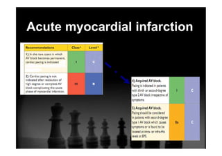 Acute myocardial infarction
 