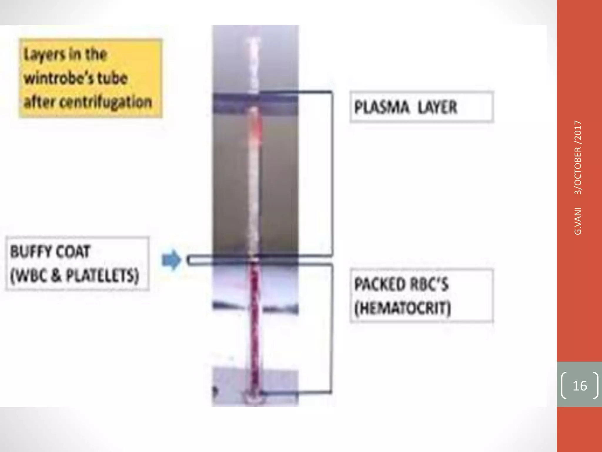 3/OCTOBER
/2017
G.VANI
16
 