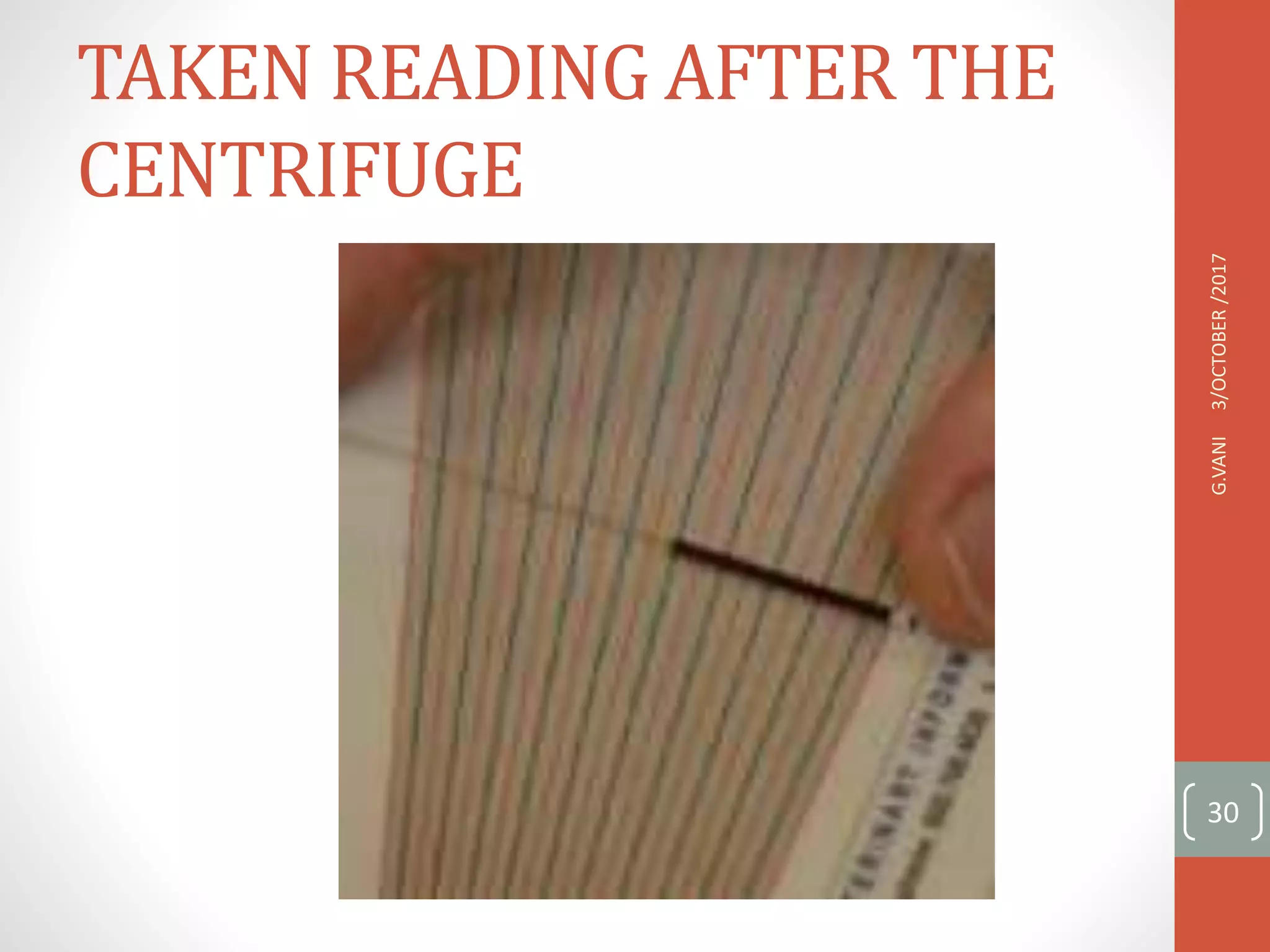 TAKEN READING AFTER THE
CENTRIFUGE
3/OCTOBER
/2017
G.VANI
30
 