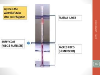 3/OCTOBER
/2017
G.VANI
16
 