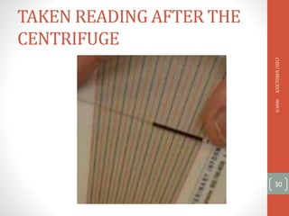 TAKEN READING AFTER THE
CENTRIFUGE
3/OCTOBER
/2017
G.VANI
30
 
