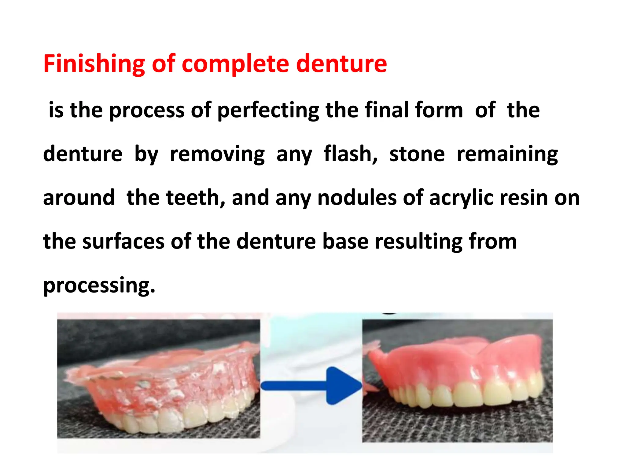 Finishing of complete denture
is the process of perfecting the final form of the
denture by removing any flash, stone remaining
around the teeth, and any nodules of acrylic resin on
the surfaces of the denture base resulting from
processing.
 