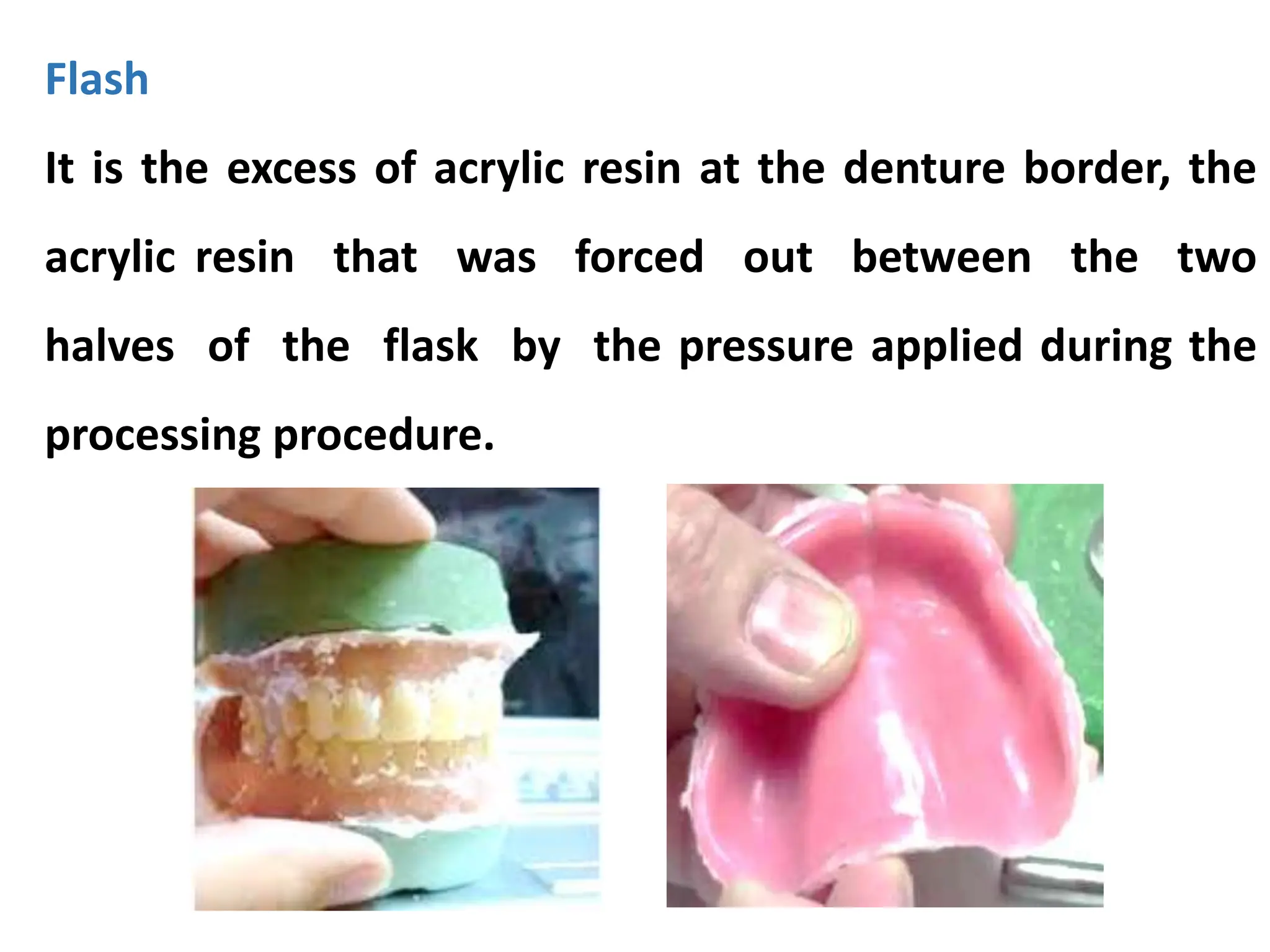Flash
It is the excess of acrylic resin at the denture border, the
acrylic resin that was forced out between the two
halves of the flask by the pressure applied during the
processing procedure.
 
