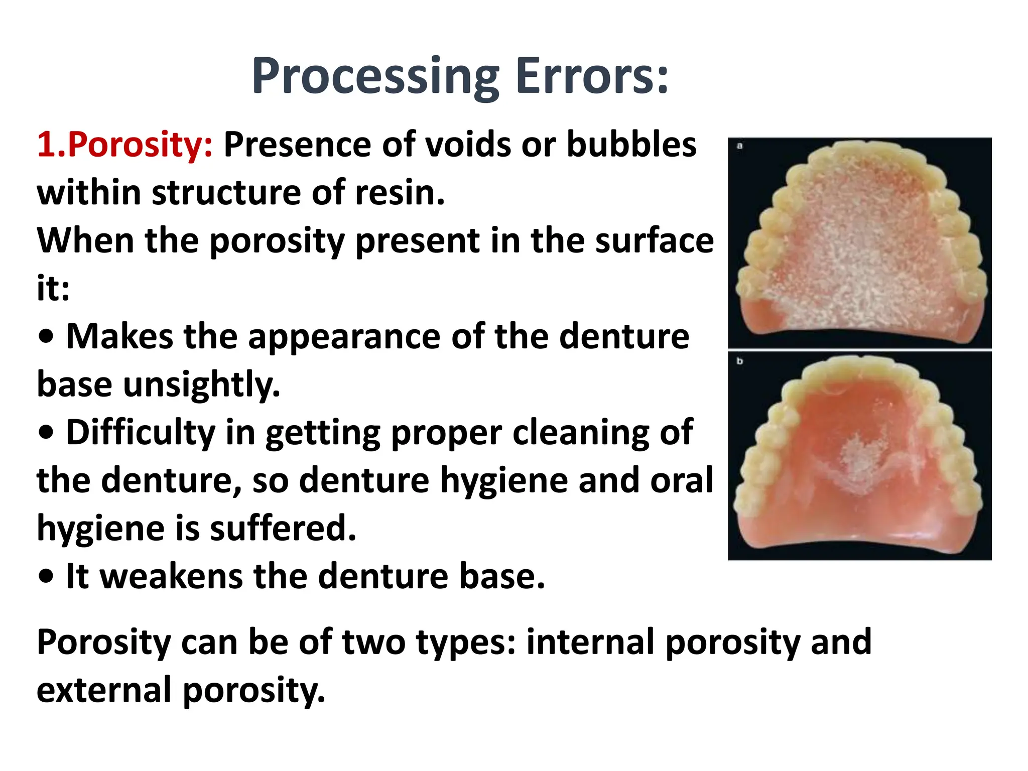 Processing Errors:
Porosity can be of two types: internal porosity and
external porosity.
1.Porosity: Presence of voids or bubbles
within structure of resin.
When the porosity present in the surface
it:
• Makes the appearance of the denture
base unsightly.
• Difficulty in getting proper cleaning of
the denture, so denture hygiene and oral
hygiene is suffered.
• It weakens the denture base.
 