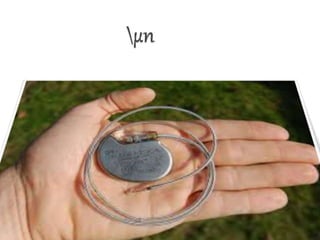 Powerpoint presentation