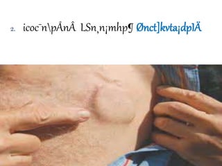 2. icoc¯npÅnÂ LSn¸n¡mhp¶ Ønct]kvta¡dpIÄ
 